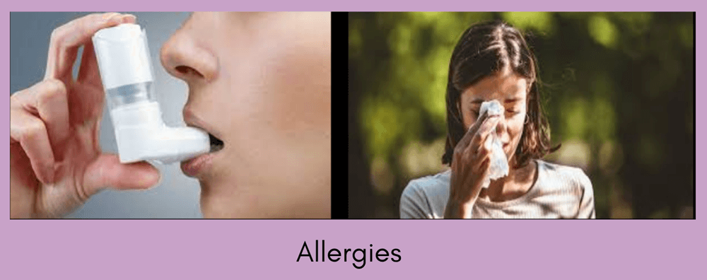 mechanism of immune response (allergies)