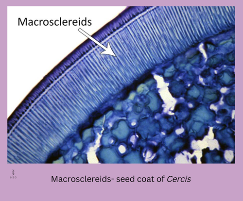 types of sclerenchyma- macrosclereids