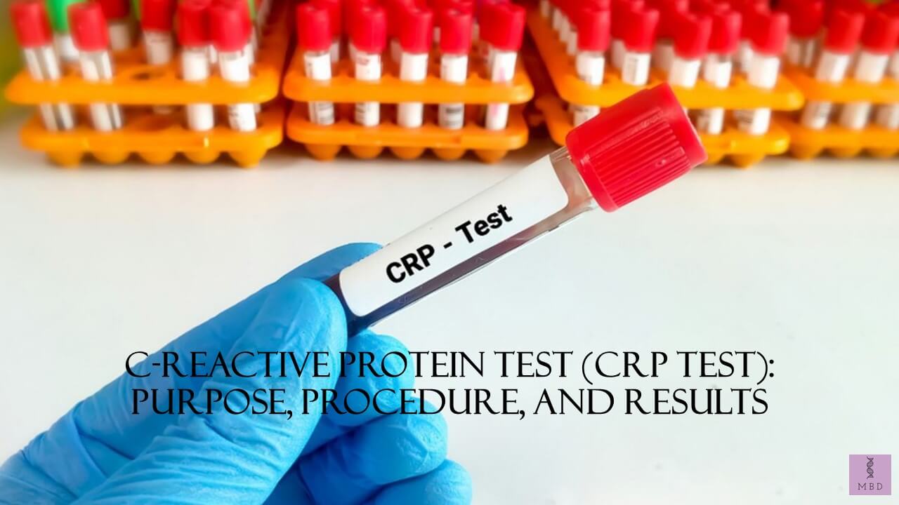 CRP blood test